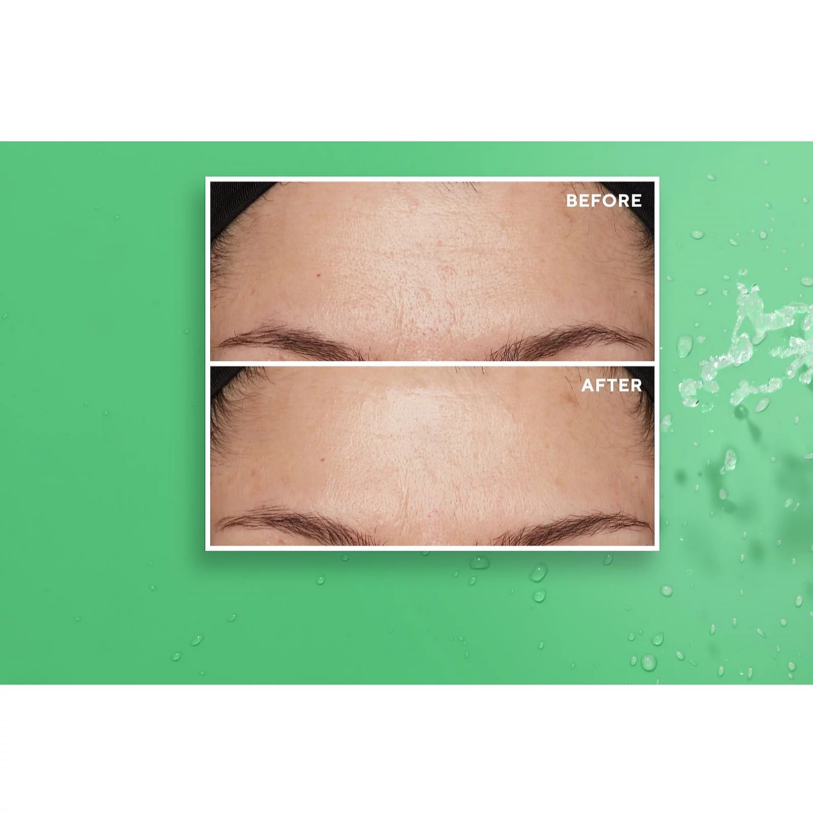 Algenist Genius Liquid Skin Resurfacing 2% BHA Toner 100ml 7 Algenist Genius Liquid Skin Resurfacing 2% BHA Toner 100ml